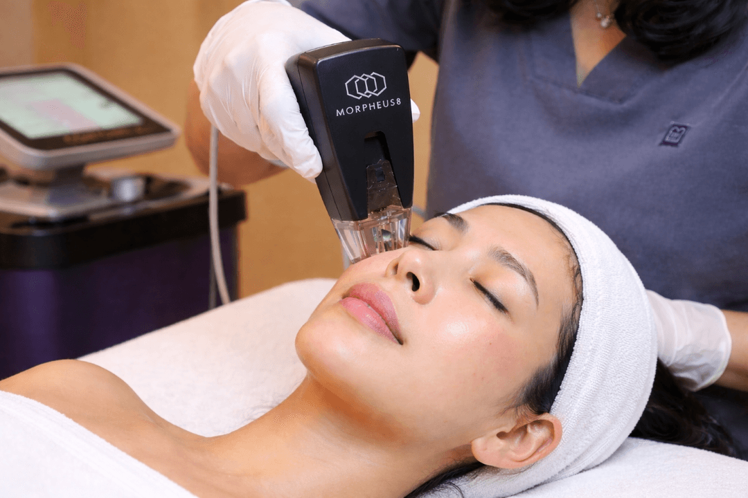 Seberapa Ampuh Morpheus8 Mengencangkan dan Menghaluskan Kulit Wajah?